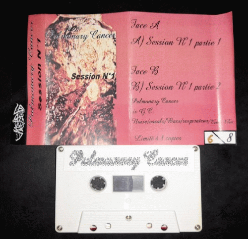 Pulmonary Cancer : Session N°1